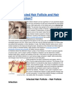 What is Infected Hair Follicle and Hair Follicle Infection?