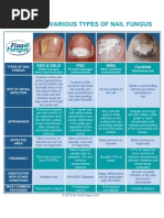 Download Identifying Types of Nail Fungus by FixaFungus SN111611685 doc pdf