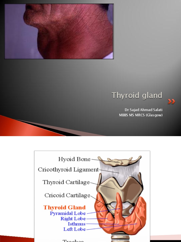 5 Thyroid Gland Lecture Pdf Thyroid Hyperthyroidism
