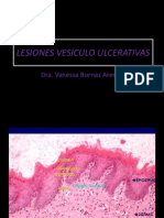 p9 - Lesiones Vesiculo Ulcerativas