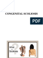 25 Congenital Scoliosis (Dr. Fazl Karam)