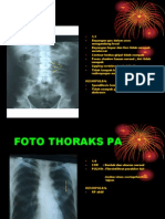 THORAX