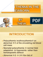 polycythemia in the newborn