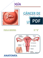 Cancer de Cervix