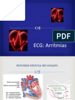 Ecg