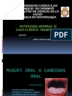 Caso Clinico de Muguet Oral