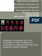 HardTissue Debris Accumulation Analysis by High-Resolution Computed Tomography