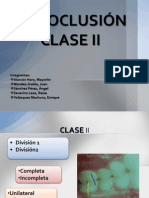 Maloclusión Clase II: Características y Tratamiento