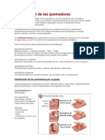 Clasificación de Las Quemaduras