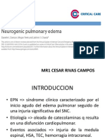 Edema Pulmonar Neurogenico