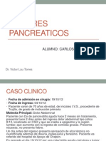 Tumores Pancreaticos