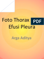 Efusi Pleura