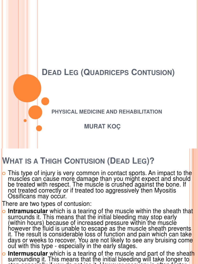 Dead Leg (Quadriceps Contusion) PDF Massage Human Leg