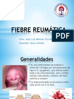 Fiebre Reumatica