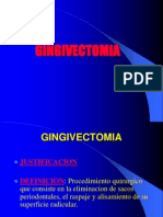 GINGIVECTOMIA