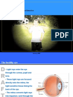 Glaucoma Presentation - Information, Risk Factors and Detection