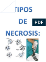 Necrosis Expo