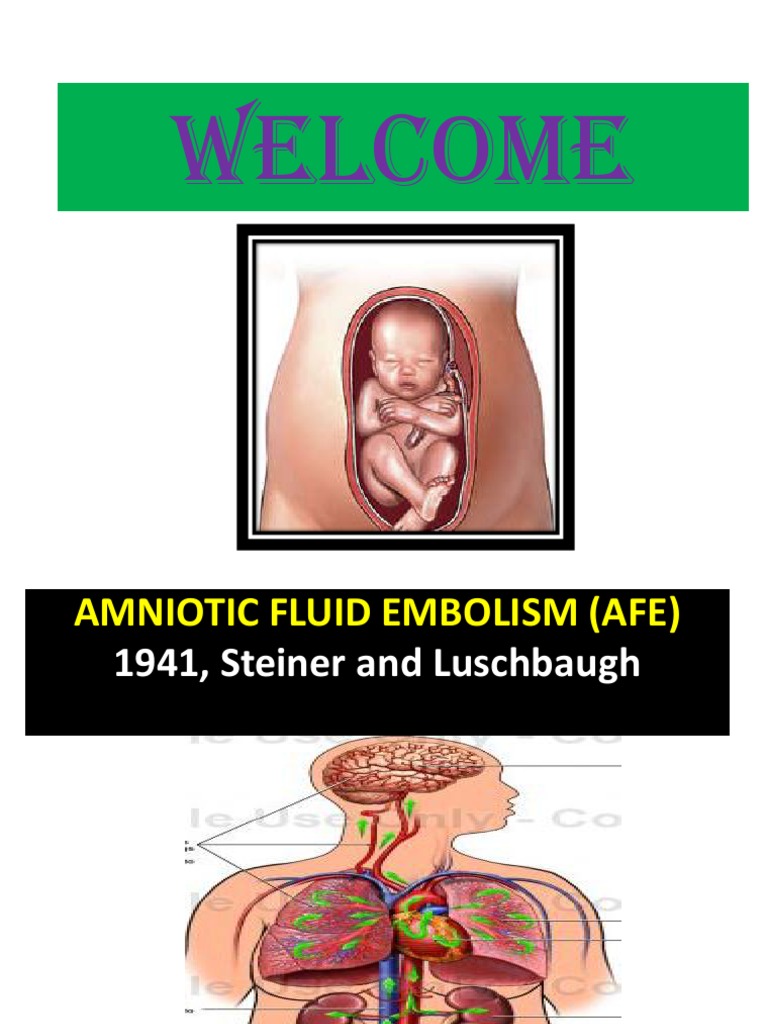 Amniotic Fluid Embolism PDF Childbirth Cardiovascular System