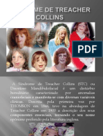 Síndrome de Treacher Collins.pptx