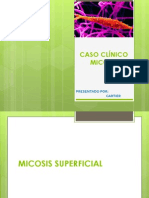 Caso Clínico Micosis