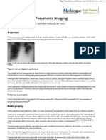 Typical Bacterial Pneumonia Imaging