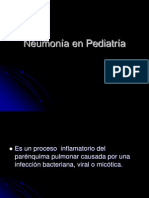 Neumonía en Pediatría