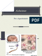 Alzheimer