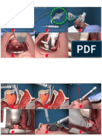 Illustrated Intubation, Step by Step.