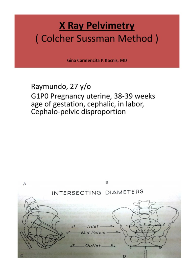 X Ray Pelvimetry | PDF