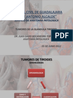 Tumores de Tiroides