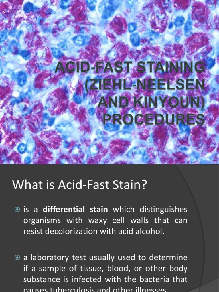 Acid Fast Staining Staining Mycobacterium