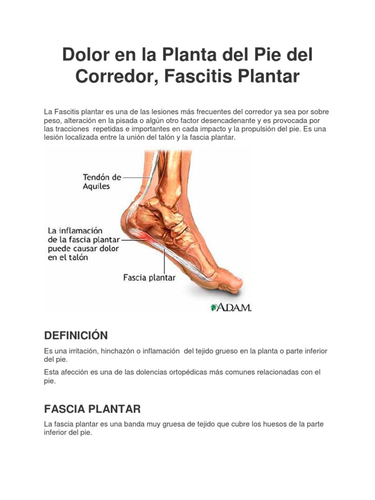 Dolor en La Planta Del Pie, Del Corredor, Fascitis Plantar