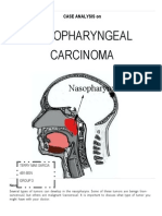 CASE ANALYSIS - Nasopharyngeal Cancer