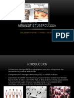Meningitis Tuberculosa