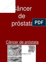 trabalho cancer de prostata.ppt
