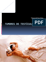 tumores de testiculo