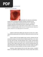 Download Diagnosa Dan Penatalaksanaan Laringitis by Muhamad Ibnu Sina SN116638153 doc pdf