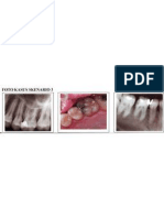 Periodontal