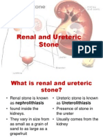 Renal Stone