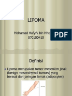 Lipoma