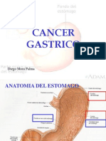 Cancer Gastrico Expo