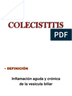 Colecistitis