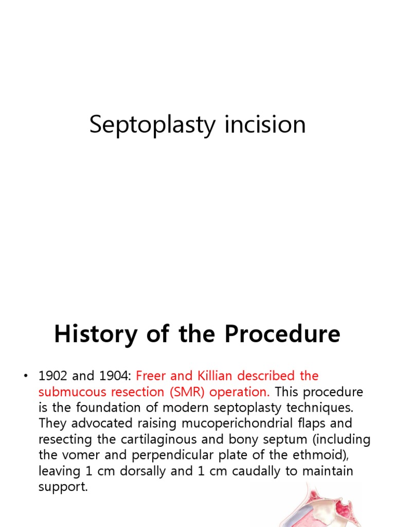 Septoplasty Incisions: Killian vs Freer | PDF
