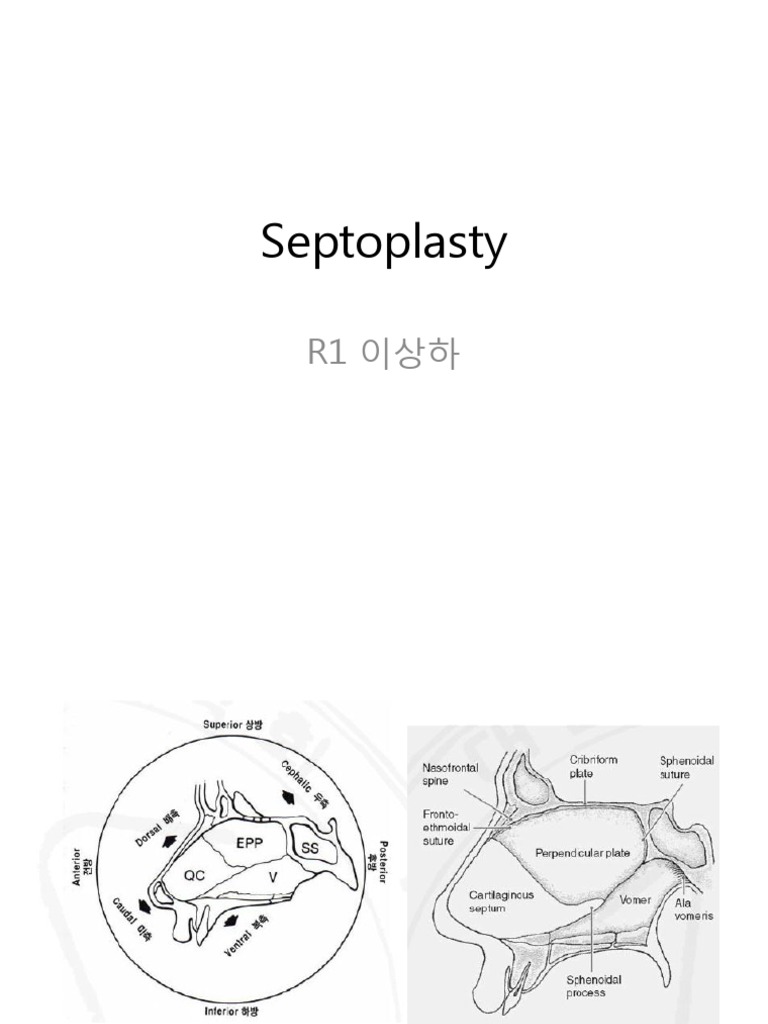 septoplasty 수술 기록지 | PDF
