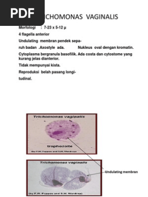 Yalangoch eshak külotlu çorapdagi fotosurat