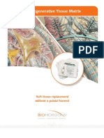 Alloderm® Regenerative Tissue Matrix: Soft Tissue Replacement Without A Palatal Harvest