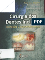 Cirurgia Dos Dentes Inclusos