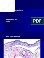 Apocrine Hidrocystoma: Deba P Sarma, MD Omaha