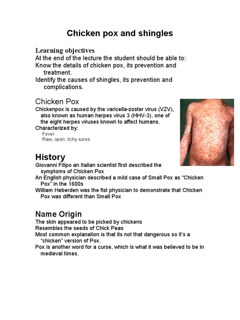 Chicken Pox and Shingles | Virology | Immunology