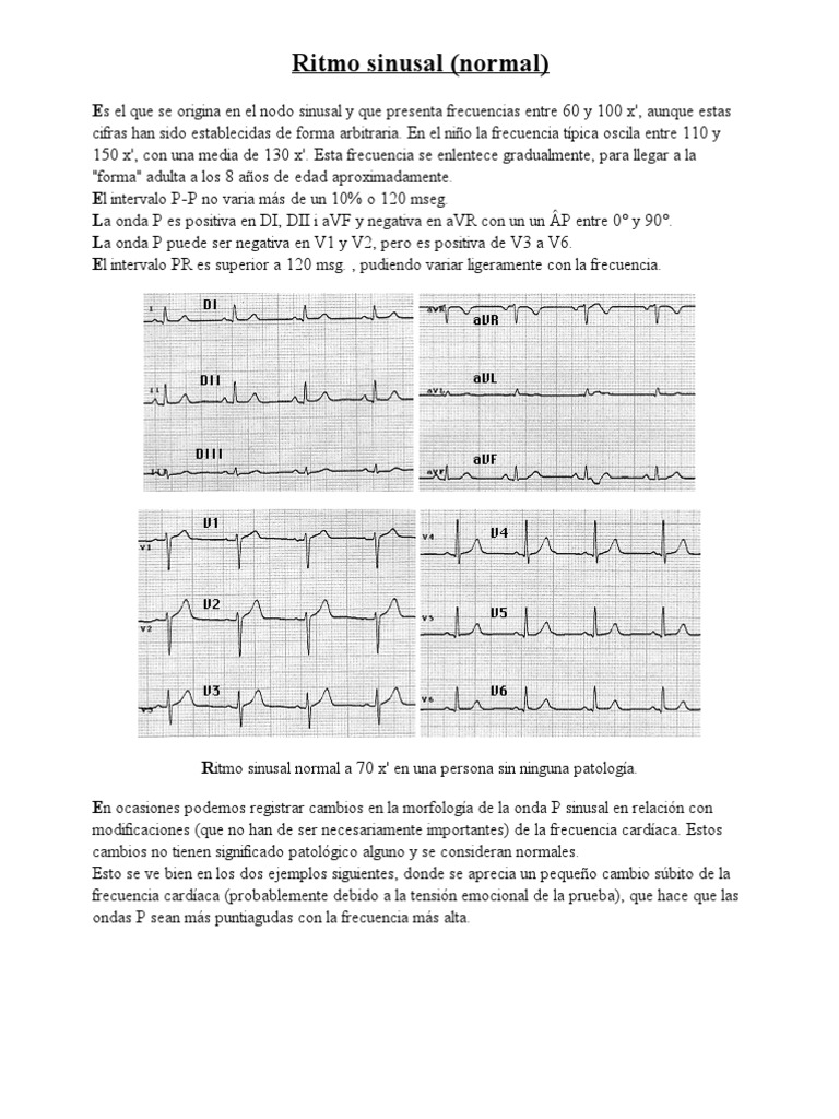 Ritmo Sinusal Normal